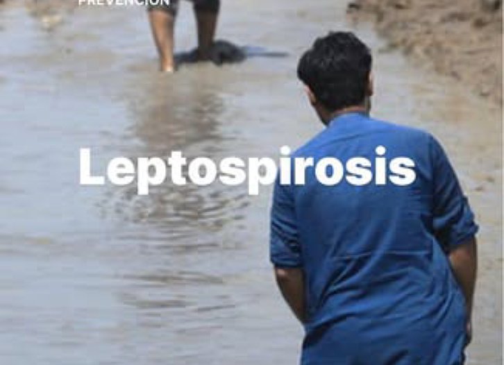 Leptospirosis